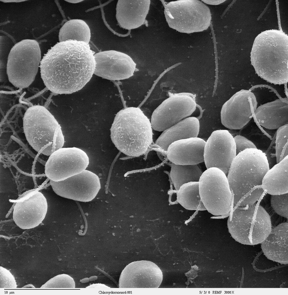 Archival scanning electron micrograph of Chlamydomonas reinhardtii algae cells and their flagella
